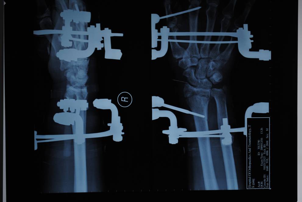 1649647402142356.jpg 201334192151153.jpg